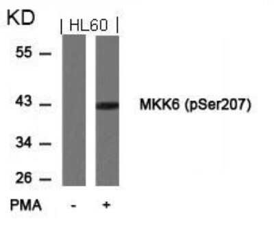 Western Blot: MKK6/MEK6 [p Ser207] Antibody [NB100-82050]